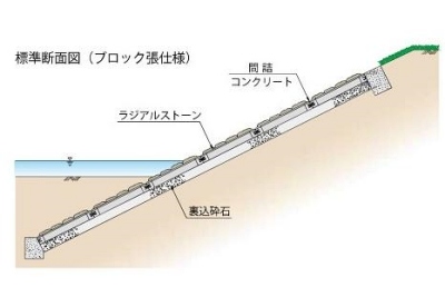 ラジアルストーン断面図